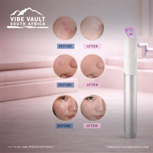 Load image into Gallery viewer, Blue/Red Light Machine for Anti-Inflammation Acne Scar Removal Wrinkle Removal Treatment Skin Tightening